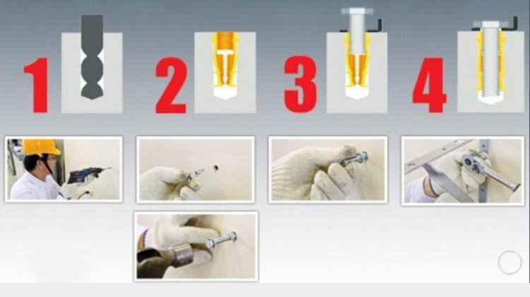 3.3. use of expansion screw